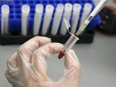 Việt Nam có đủ khả năng xét nghiệm virut Zika
