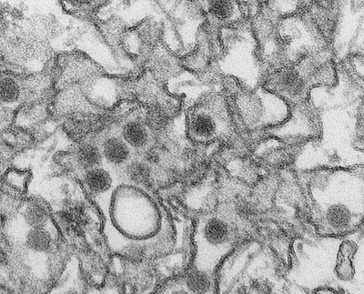 Phát hiện đáng sợ: Virus Zika lây qua đường tình dục