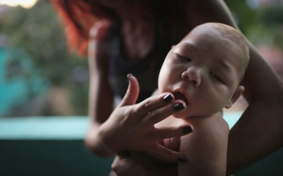 Bộ Y tế khuyến cáo phòng bệnh do virus Zika