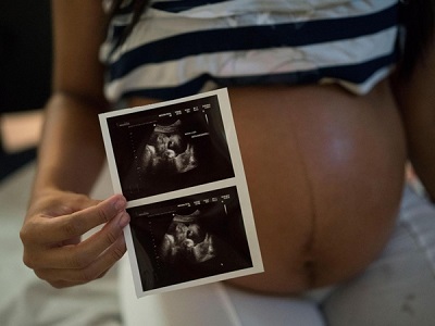 Vi rút zika đang gia tăng: Khuyến cáo đối với phụ nữ