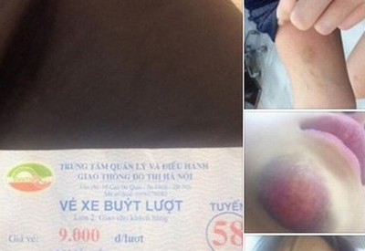 Phụ xe buýt sàm sỡ, tấn công cô gái trẻ giữa ban ngày?