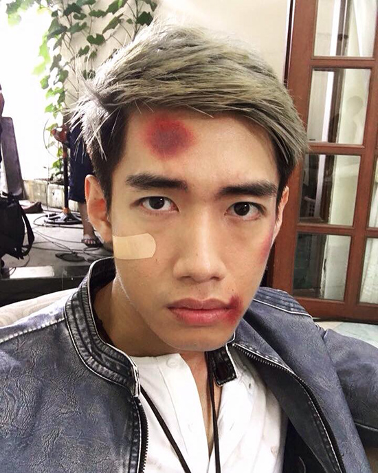 Quang Đăng chịu nhiều bầm dập trong phim