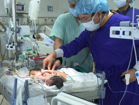 Hai bé dính nhau ở Hà Giang đã tử vong