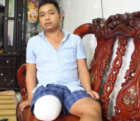 Có dấu hiệu hình sự vụ bị cưa chân do bác sĩ chẩn đoán sai