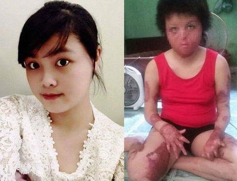 Bắt khẩn cấp người chồng thiêu sống vợ xinh đẹp