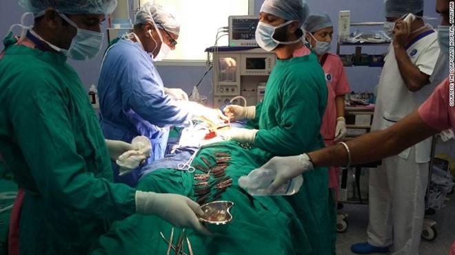Phẫu thuật lấy 40 con dao ra khỏi dạ dày của người đàn ông