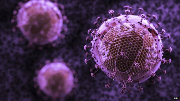 HIV/AIDS đã có thể được chữa trị hoàn toàn