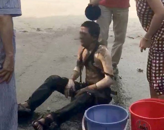 No tram bien ap, 5 nguoi bi bong hinh anh 2
