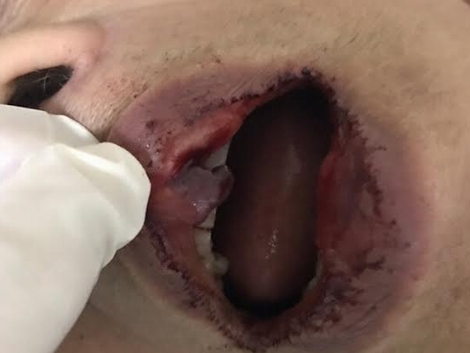 Vụ tiến sĩ 76 tuổi bị hành hung: Công an vào cuộc điều tra