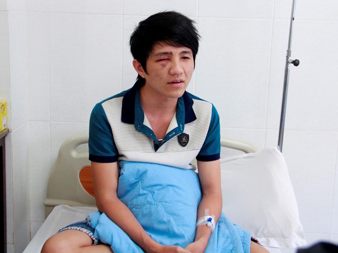 Thanh niên va mặt vào gậy CSGT vì không làm chủ tốc độ