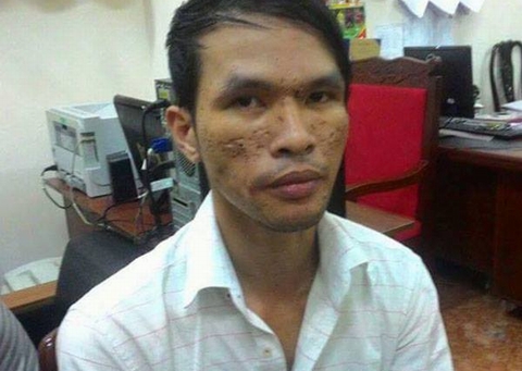 Nghi can bạo hành trẻ em gây rúng động khai gì?