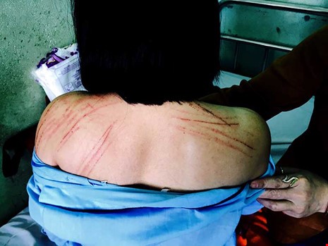 Luật sư tố bị nguyên đơn đánh gãy 2 cái răng