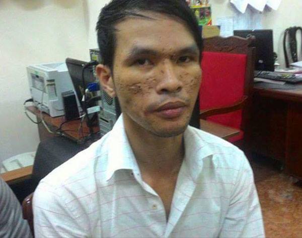 Lời khai của nghi can bạo hành trẻ em gây rúng động