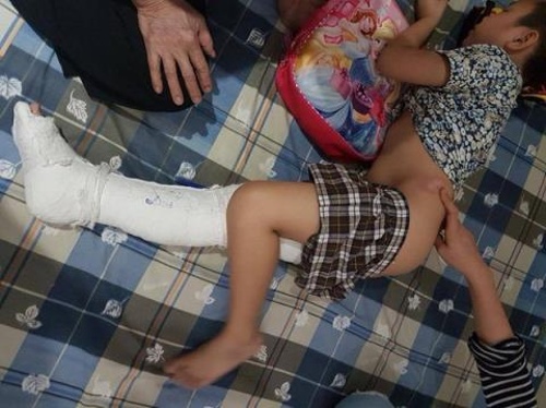 Vụ học sinh bị gãy chân: Giáo viên sợ bị &quot;trù&quot; khi khai sự thật