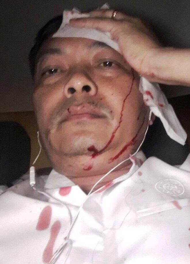 giam doc nhan su ca phe trung nguyen bat ngo bi tan cong nhap vien hinh anh 1