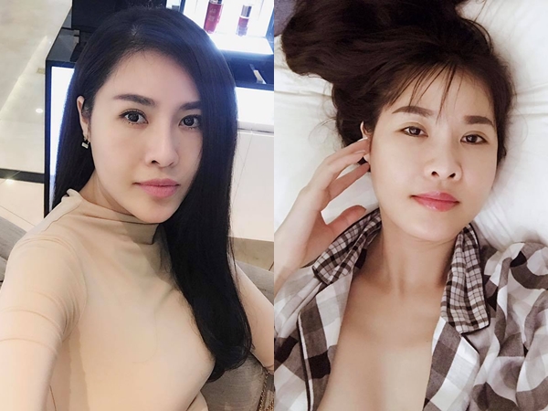 Nghi vấn Quế Vân phẫu thuật thẩm mỹ tân trang lại nhan sắc