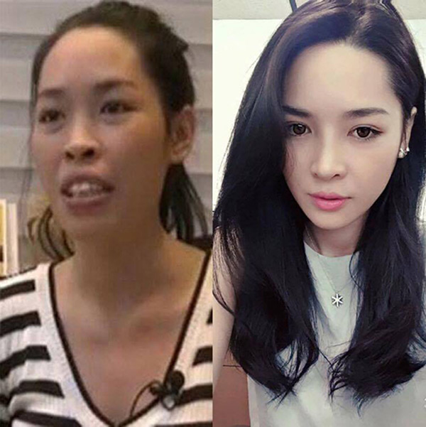 Cô gái đổi đời nhờ phẫu thuật thẩm mĩ