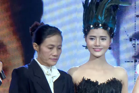 Sau khi phẫu thuật, Hiên trở nên xinh đẹp
