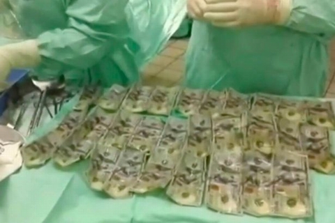 Nuốt 160 triệu vào bụng vì giận chồng