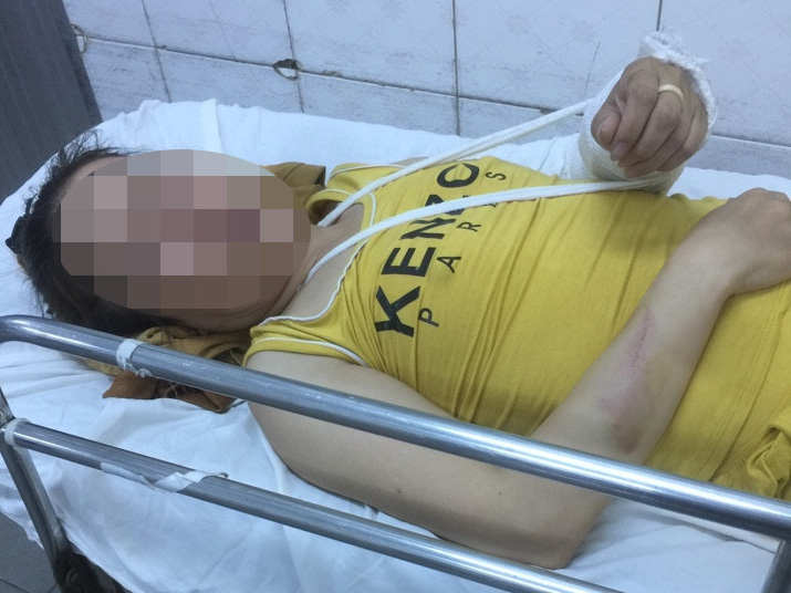 Người vợ trần tình sau khi đổ dầu ăn đun sôi vào chồng