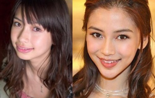 AngelaBaby phủ nhận việc mình có can thiệp phẫu thuật thẩm mĩ trên khuôn mặt nhưng cô lại chia sẻ thẳng thắn về chuyện mình đã niềng răng. Có thể nhìn rõ sự thay đổi của AngelaBaby hiện tại so với bức ảnh trước kia đúng không?. Hàm răng bẩm sinh khi chưa niềng chìa ra khiến môi trở nên dày hơn, khiến cho bà xã Huỳnh Hiểu Minh có nụ cười gượng gạo.