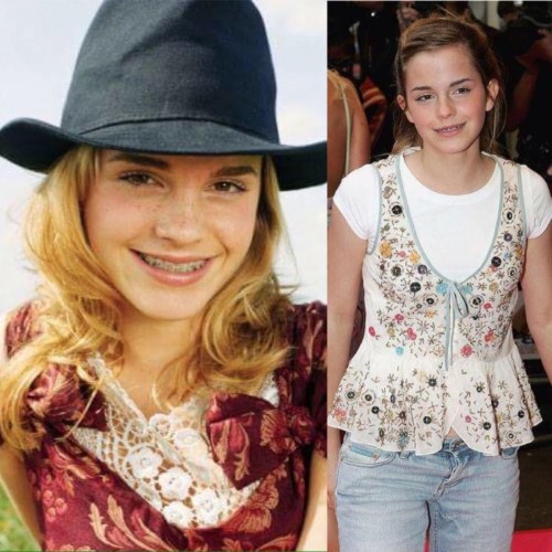 7. Emma Watson  Dù đang niềng răng nhưng Emma Watson vẫn rất tự tin cười thoải mái khi chụp ảnh tạp chí. Và đương nhiên là sau thời gian niềng răng, Emma Watson càng trở nên rạng rỡ. 