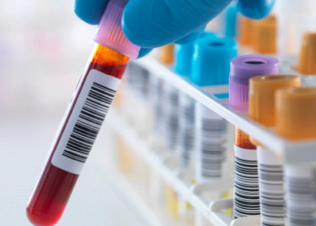 Ca nhiễm HIV được chữa khỏi thứ 3 trên thế giới