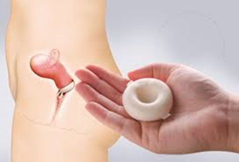 Biện pháp tránh thai hiện đại đã tăng lên 67%
