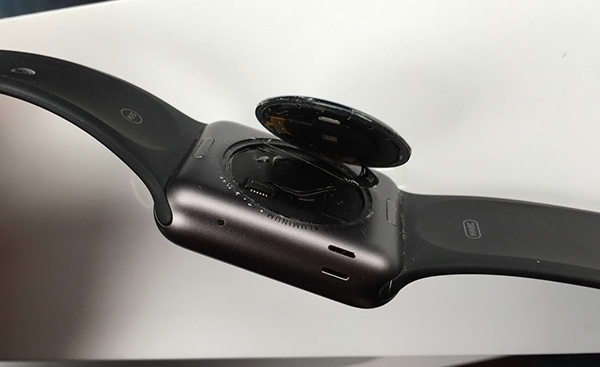 Apple sửa miễn phí Apple Watch đời đầu bị bung nắp sau