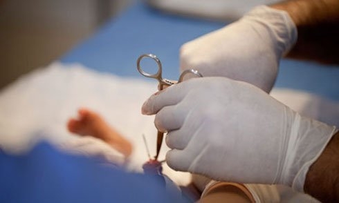 Xử lý hẹp bao quy đầu cho trẻ không phụ thuộc vào tuổi