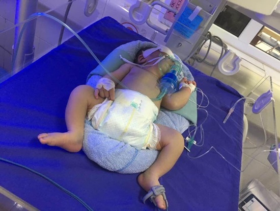 Thay máu, cứu sống 2 trẻ sơ sinh dưới 10 ngày tuổi