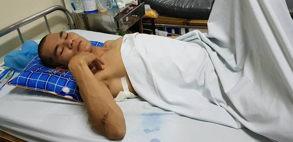 Vụ ca sĩ bị chém gục trên phố: Hành vi phạm tội côn đồ hung hãn