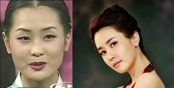 Những cú lột xác ngoạn mục của sao Hàn nhờ phẫu thuật thẩm mỹ hình ảnh 1 Nhắc đến những lần biến đổi khó tin nhất của sao Hàn, Lee Dae Hae thường được nghĩ tới đầu tiên. Dù việc trở thành
