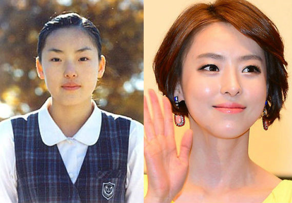 Lee Da Hee, nữ diễn viên trong phim I Hear Your Voice cũng là gương mặt điển hình khi nhắc tới phẫu thuật thẩm mỹ thành công ở Hàn Quốc. Cô sở hữu gương mặt xinh đẹp, phong thái quyến rũ, lạnh lùng. Tuy nhiên, cô có được vẻ đẹp này một phần cũng nhờ phương pháp