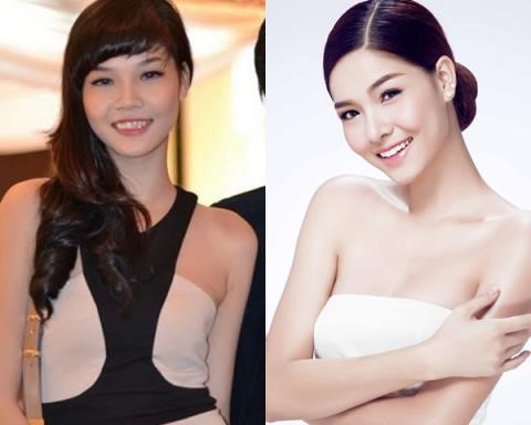 Sở hữu chiều cao đúng chuẩn người mẫu thế nhưng nhan sắc của Kỳ Hân khi mới bước vào nghề chỉ được đánh giá bình thường, hơi quê với hàm răng khấp khểnh và sống mũi tẹt. Sau khi trải qua 4 lần phẫu thuật thẩm mỹ, Kỳ Hân đã có được gương mặt thon gọn, hàm răng đều, sống mũi cao và mảnh hơn.