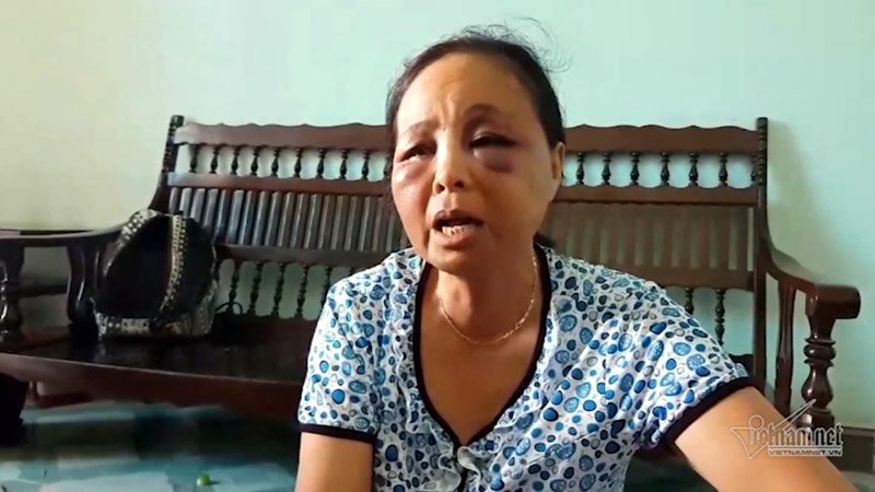 Triệu tập nhiều đối tượng hành hung 2 phụ nữ bán tăm