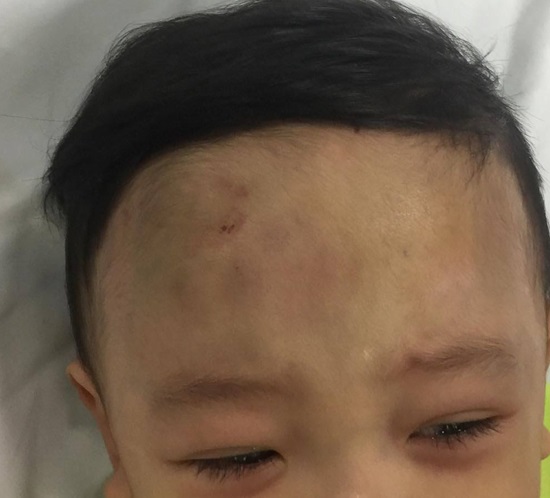 Cháu bé bị bạo hành xuất viện, được ông bà ngoại đón về nuôi