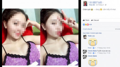 Thai phụ 22 tuổi tử vong sau khi nâng ngực 10 ngày