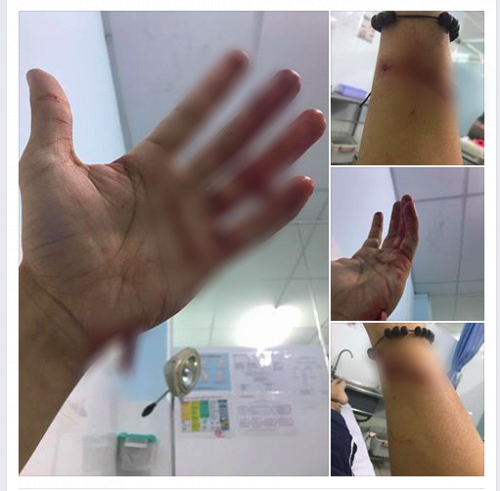Nam ca sĩ cũng đính kèm loạt ảnh cánh tay bị thương.