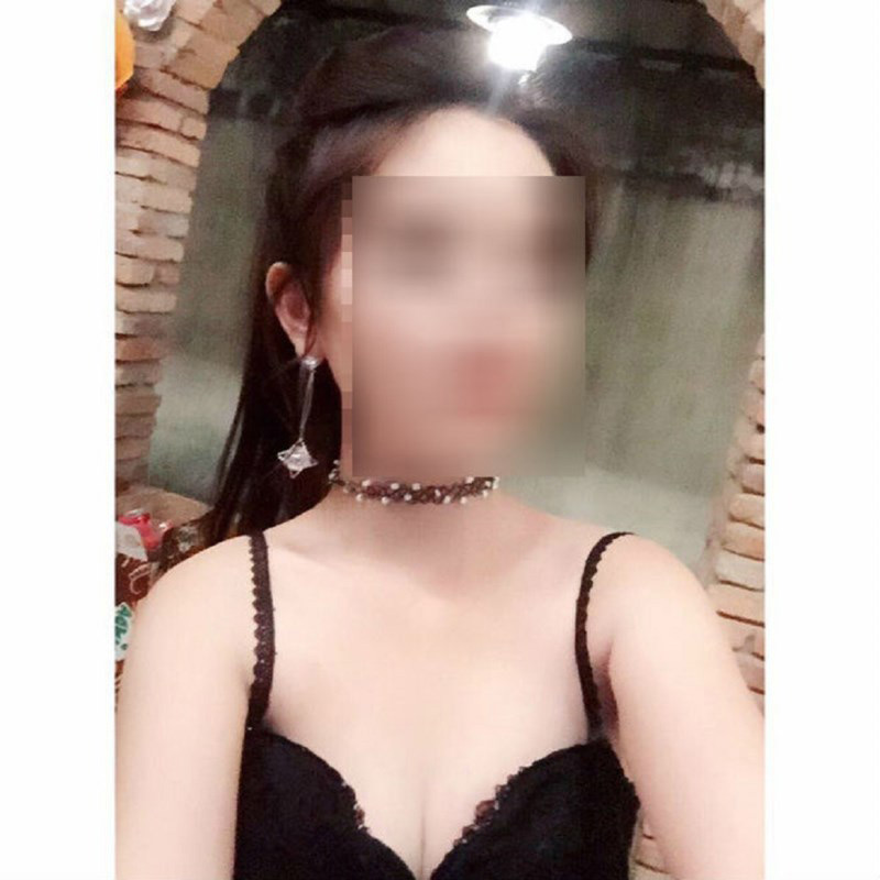 Hình ảnh sau phẫu thuật được nạn nhân S.B.T đăng lên FB cá nhân