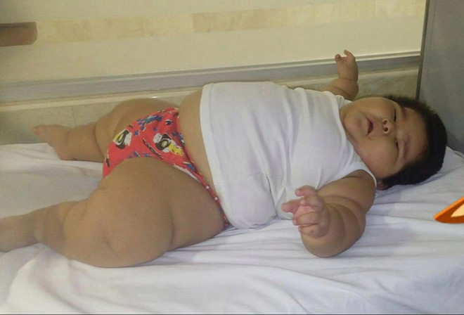 Bé trai 10 tháng nặng gần 30 kg
