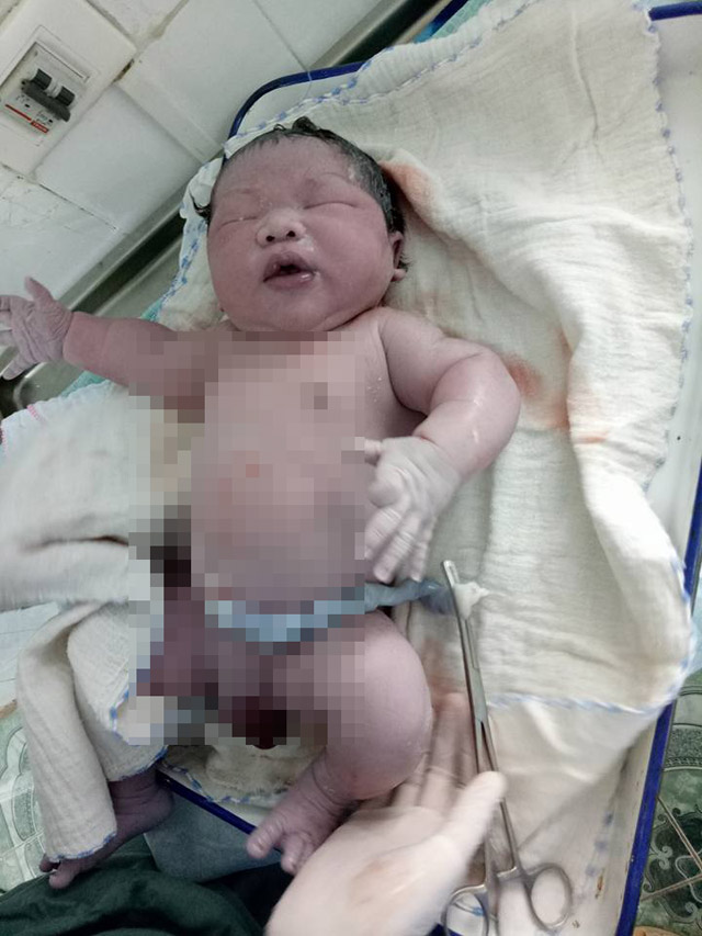 Bé trai chào đời với cân nặng kỷ lục 7,1kg ở Vĩnh Phúc
