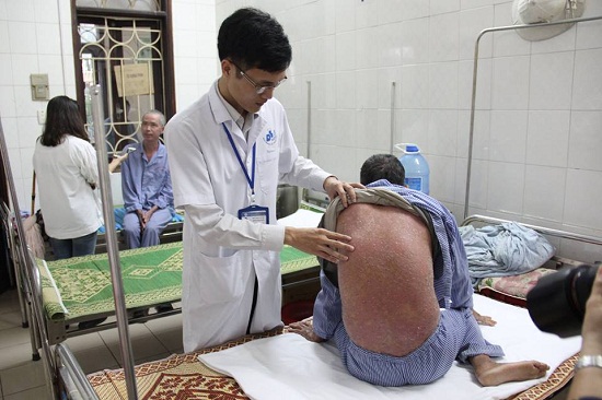 Bác sĩ chữa bệnh vảy nến