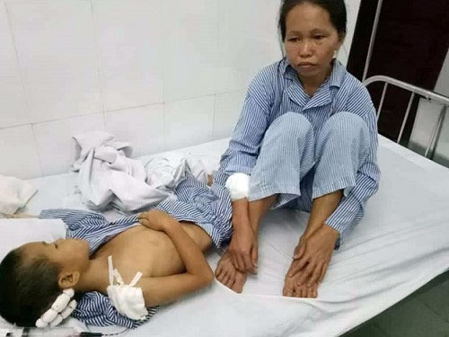 Những chiêu giúp phụ nữ bảo vệ mình khi bị chồng bạo hành