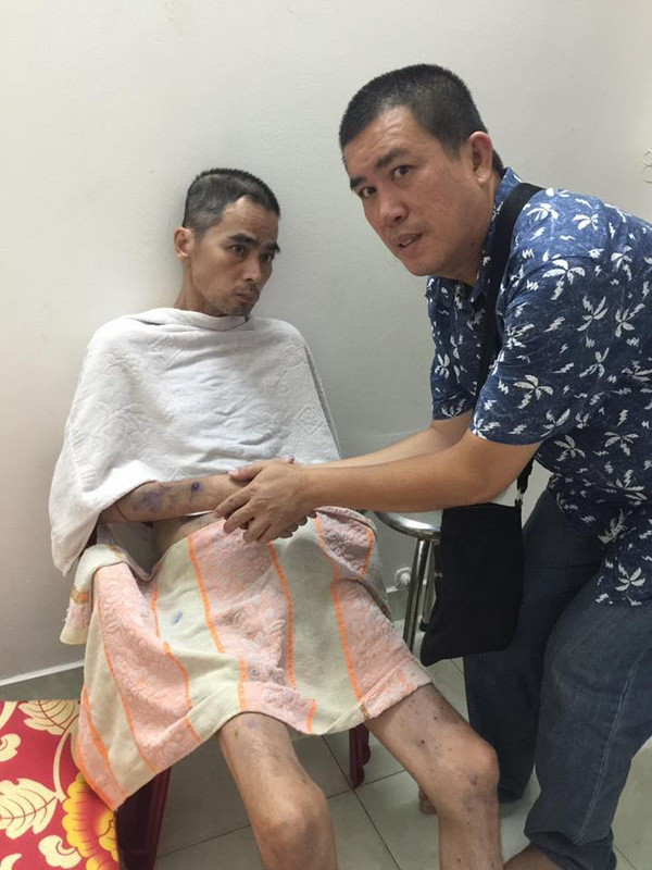 Nguyễn Hoàng sau cơn tai biến nặng đã không thể đi lại, suy hô hấp.