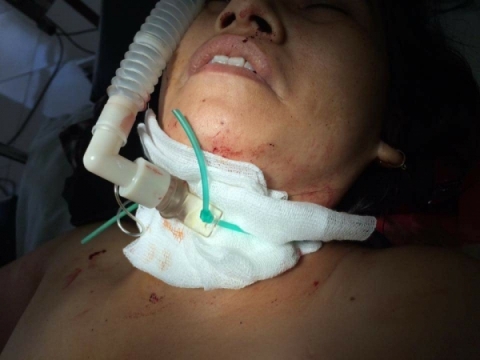Nữ chủ tiệm cắt tóc bò ra ngoài kêu cứu khi bị thiếu niên 16 tuổi cứa cổ