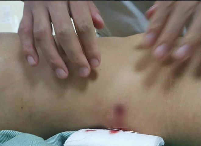 Vụ cô gái trẻ trúng đạn lạc: Triệu tập đối tượng nổ súng