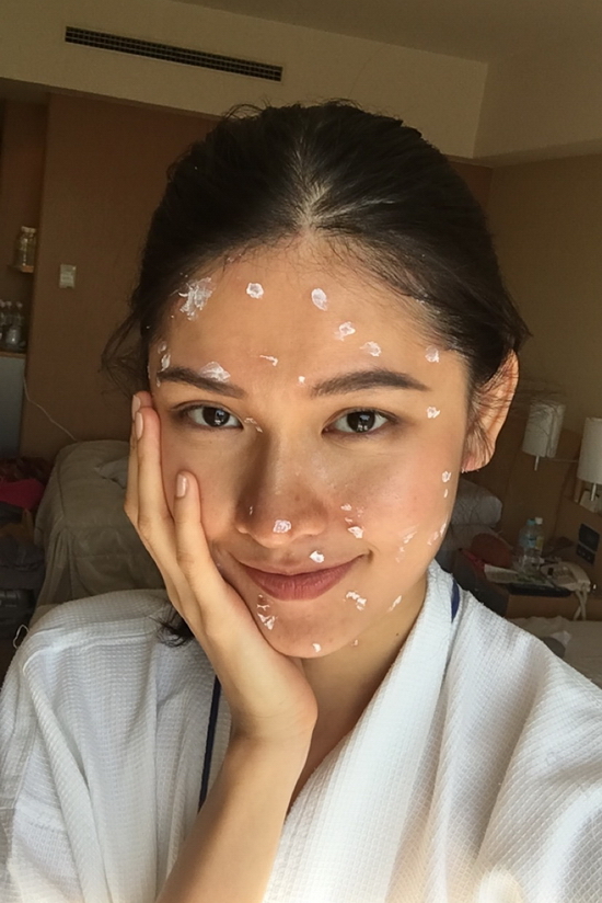 Thùy Dung bị bệnh thuỷ đậu trước thềm chung kết Miss International