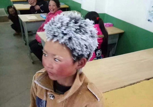 Bé trai tóc đóng băng được các nhà hảo tâm hỗ trợ hàng triệu đô la